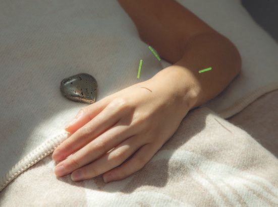 Acupuncture healing at Helia House. PHOTO BY CARLOS VELEZ, COURTESY OF DR. ELIZABETH TRATTNER